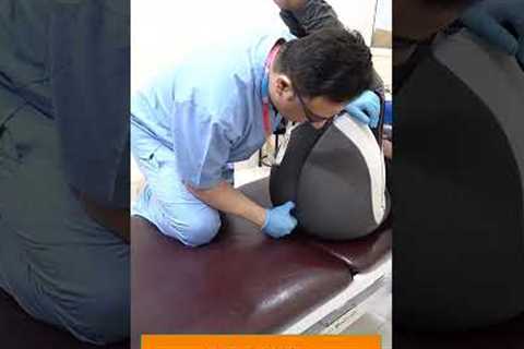 CHIROPRACTIC IN INDIA | SACRUM PAIN | COCCYDYNIA | DR. VARUN DUGGAL CHIROPRACTIC IN INDIA #shortfeed