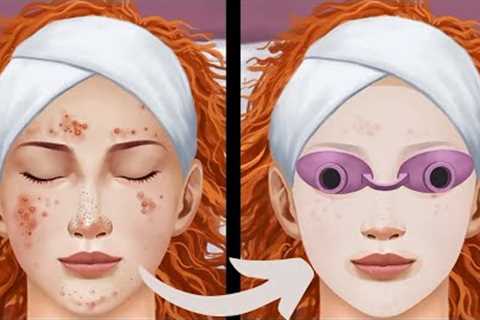 Ultimate Satisfying Acne Blackhead Removal ASMR Animation for Clear Skin Care | #asmr #animation