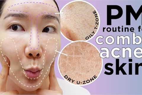 PM Skincare Routine for clearing acne! Oily T-zone &amp; Dry U-Zone Acne Sensitive Skin!