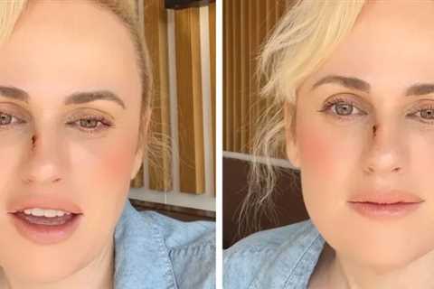 Rebel Wilson Details Stunt Accident That Sent Her to Hospital for Stitches