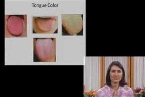 Tongue Diagnosis - Traditional Chinese Medicine and Acupuncture