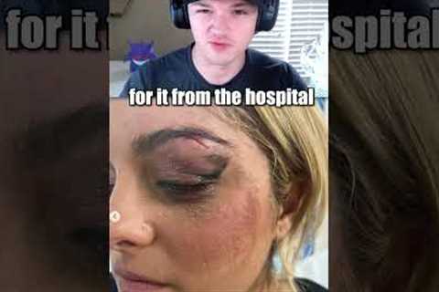 This Celebrity Got Injured At A Concert