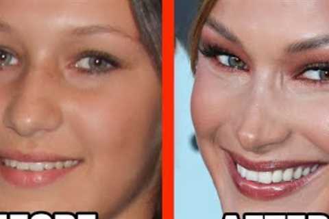 The Top 10 Celebrities who have had their Cat Eye Surgery BOTCHED