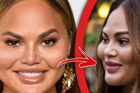 The Top Ten Plastic Surgery Disasters that Celebrities Have Tried to Hide