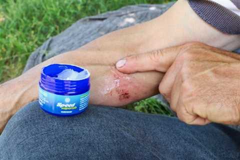 So, Is Vicks Vaporub Flammable?