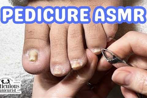 👣ASMR Pedicure Cleaning💆‍♀️Pedicure Tutorial: How to Fix Pincer Toenails👣