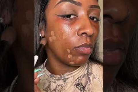 I covered my ACNE spots with Concealer and it turned out… 😳👀 #makeup