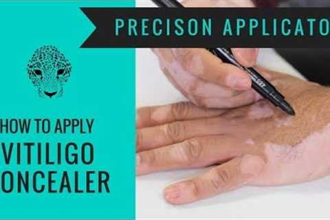 Vitiligo Makeup Tutorial - How to Cover Vitiligo - Zanderm Precision Applicator