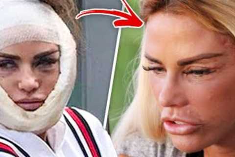 The Top 10 Celebrities who went WAY too far with Botox