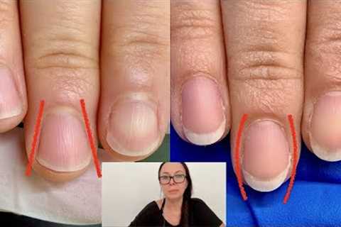 How I shaped these nails from fanning out to oval. [Nail technician explains]
