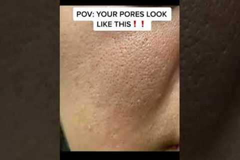 Do you PORES LOOK THIS LARGE?!!!! #skincareroutine #skincare