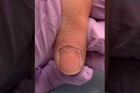 Damaged After Manicure 🙀😭😳