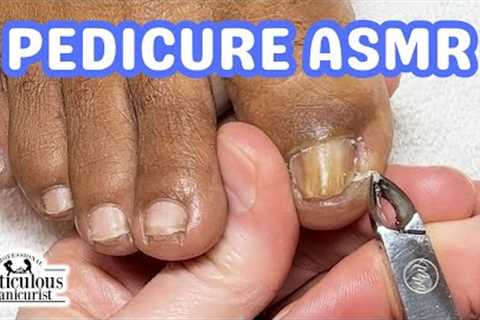 👣ASMR Pedicure Cleaning💆‍♀️How to Fix Big Toenails &amp; Pinky Nails Pedicure Tutorial👣