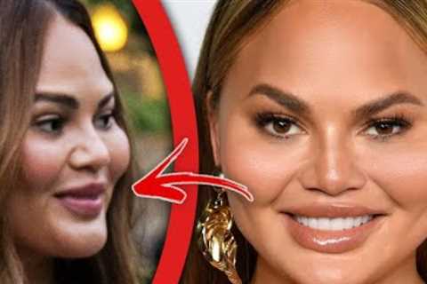 Celebrities who DESTROYED their face with filler
