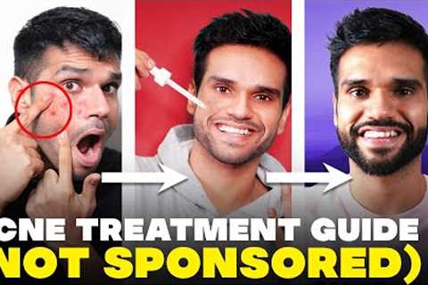 PIMPLE pe thook mat bro! Acne Treatment Guide | How To Remove Acne | BeYourBest Skincare San Kalra