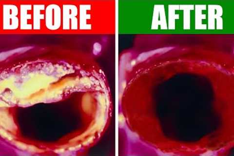 The BEST Meal to Clean Out Your Arteries