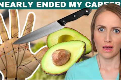 How an avocado almost RUINED My Surgical Career...