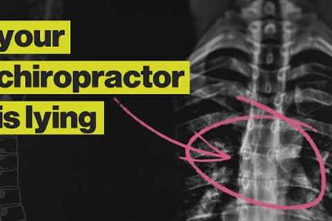 Chiropractors Are Not What You Think They Are