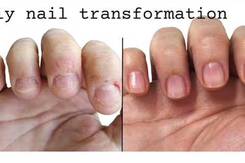 From biting nails to beautiful (and healthy!) nails!