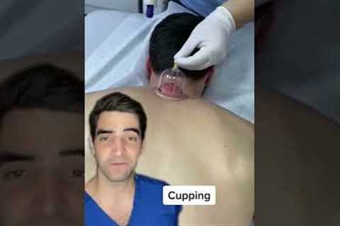 Cupping, does it work?