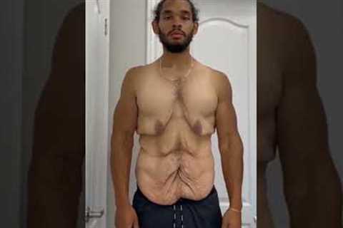 Weight Loss Transformation #SHORTS