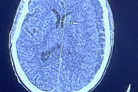 It’s not brain surgery … or is it?