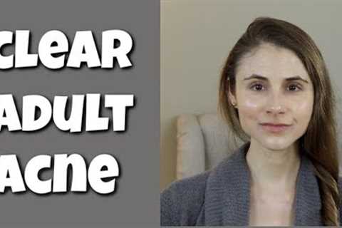 Adult acne: what you need to know to clear your skin| Dr Dray