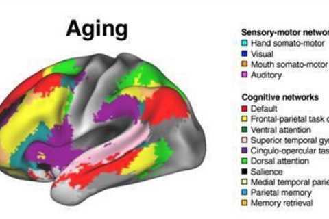 Study reveals broader impact of Alzheimer’s on brain function