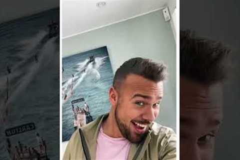 HAIR TRANSPLANT TIKTOKKERS: A QUİCK LOOK TO JOHANNES' TRANSFORM