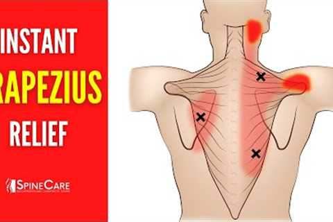 How to Relieve Trapezius Pain FOR GOOD
