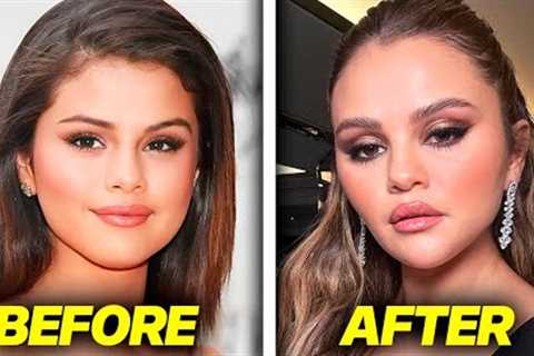 Selena Gomez PLASTIC SURGERY Backlash (fans aren't loving it)