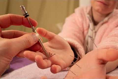 ASMR Hand Acupuncture Therapy, Soft Talking