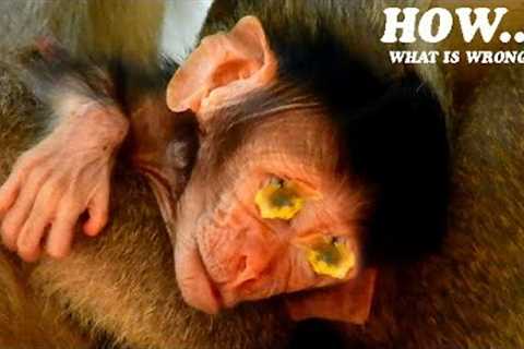 I can't see...What's wrong with baby's eyes ??