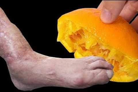 Leg pain, rheumatism, varicose veins, arthritis, headache, joint pain. Mom's Natural Remedy