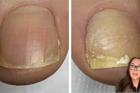 She wore nail polish only on 1 foot (and here is what happened)