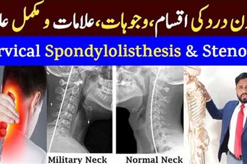 Cervical Spondylosis Treatment | Gardan Dard Ka Ilaj | Stenosis, Straightening Causes &amp; Symptoms