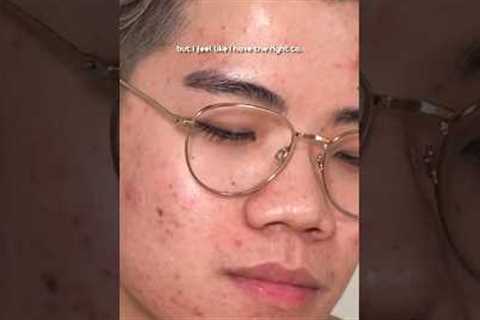 The SECRET to clear skin. #acne #skincare #skincareroutine