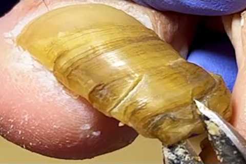 Full manicure of toenails, extremely long!【Xue Yidao】