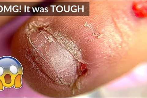 Extremely Bitten Nails To Long -  Manicure &amp; Extensions Transformation