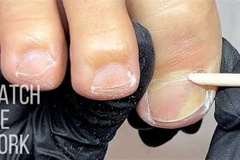 Gentle dry pedicure technique, thick stubborn cuticle | Watch Me Work