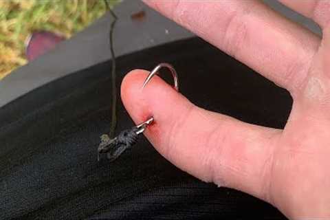 Removing A Fishing Hook From Finger (GRAPHIC)