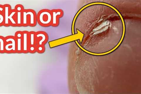 She Sliced Her Nail with This Manicure Tool 😱