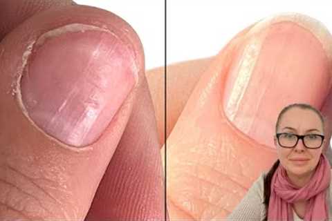 She followed my advice and these are her nails now!