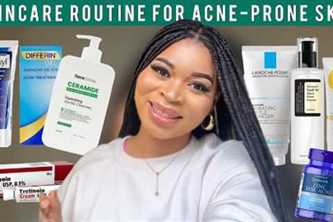 SKINCARE ROUTINE FOR ACNE-PRONE SKIN || DOs DON’Ts