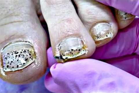 Gel Pedicure for Professional Dancer 💃