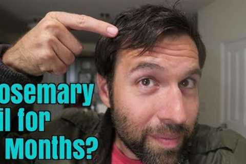 Rosemary Oil for My Hair Loss: Photos Before and After, 6 Month Experiment