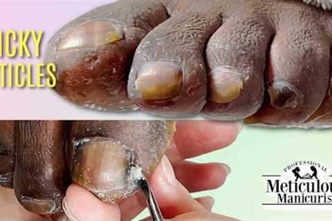 👣MENS Pedicure Sticky Cuticles on Toenails ASMR 👣
