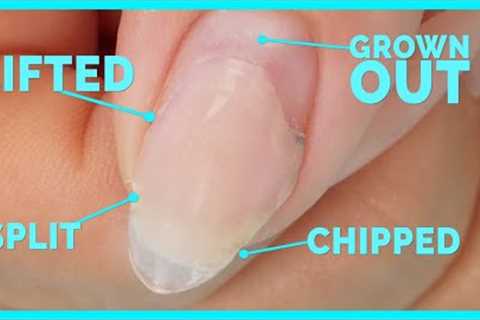 Fix Broken Gross Nail WITHOUT Removing It All!