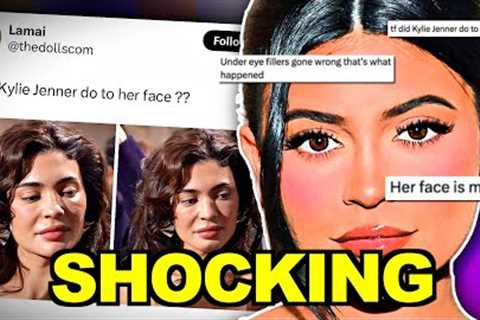 WHAT HAPPENED TO KYLIE JENNER?!