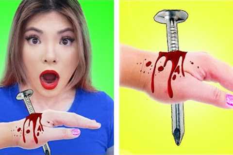 Remedies Life Hacks | Health Hacks &amp; DIY First Aid Tips and Tricks